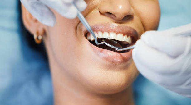 Best Chipped Tooth Repair Near Me  in Oak Harbor, OH